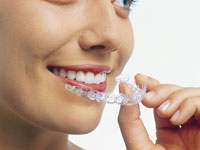 Dr Peter Scott Orthodontist Invisalign Treatments